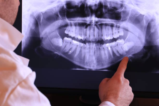 Best Broken or Cracked Tooth Emergency Dentist in Edgewood, MD