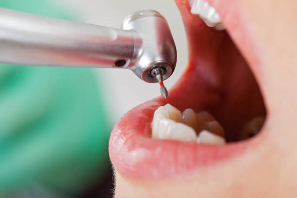 Best Mobile Emergency Dentist in Edgewood, MD